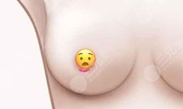 丰胸精神打一生肖、与积极行动的完美结合